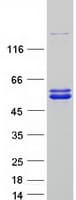Human JMJD6 / PSR Protein (Recombinant Myc-DDK (Flag))