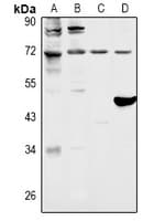 Polyclonal Rabbit anti-Human FOXO1 / FKHR Antibody (IHC, IF, WB)