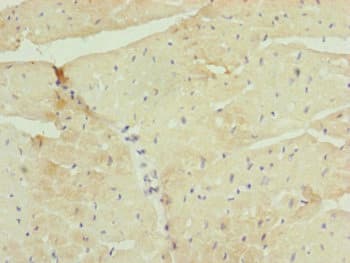 Polyclonal Rabbit anti-Human UQCR10 / UCRC Antibody (IHC)
