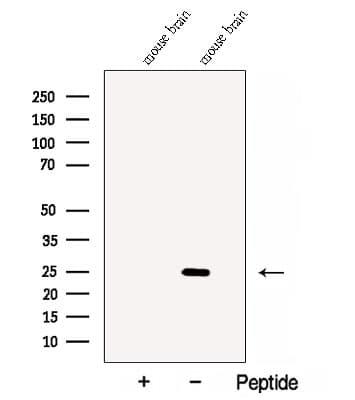 Polyclonal Rabbit anti-Human Calneuron-1 / CALN1 Antibody (WB)