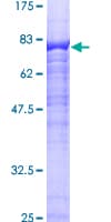Human RGS14 Protein (Recombinant GST)