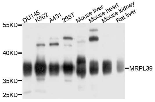 Polyclonal Rabbit anti-Human MRPL39 Antibody (WB)