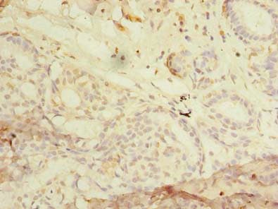 Polyclonal Rabbit anti-Human RHOC Antibody (IHC)