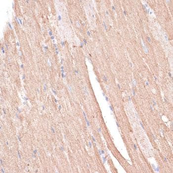 TWIK1 / KCNK1 Antibody