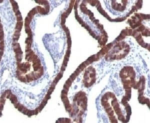 KRT7 / CK7 / Cytokeratin 7 Antibody (clone KRT7/760, Ready-to-Use)