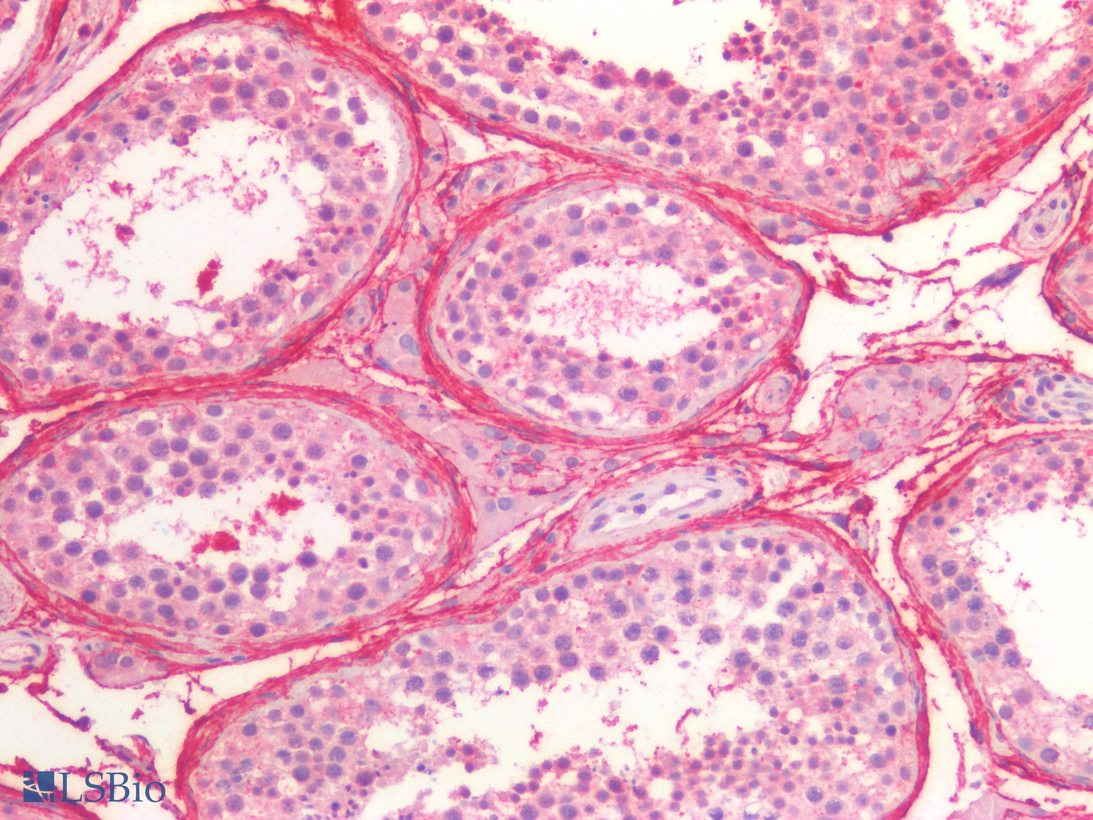 PathPlus™ FBN1 / Fibrillin 1 Antibody