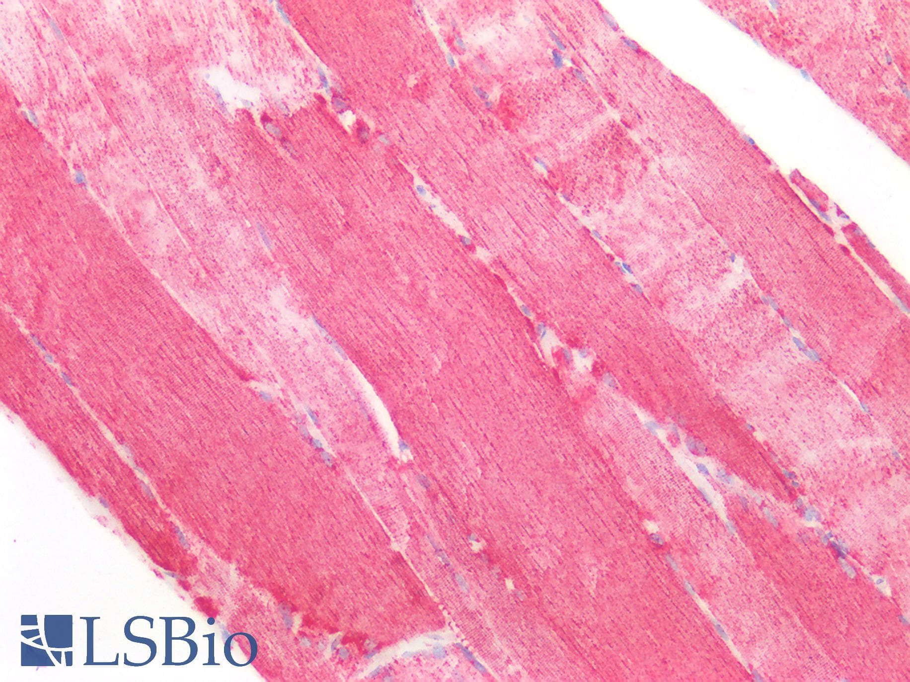 PathPlus™ SOD2 / Mn SOD Antibody (aa77-91)