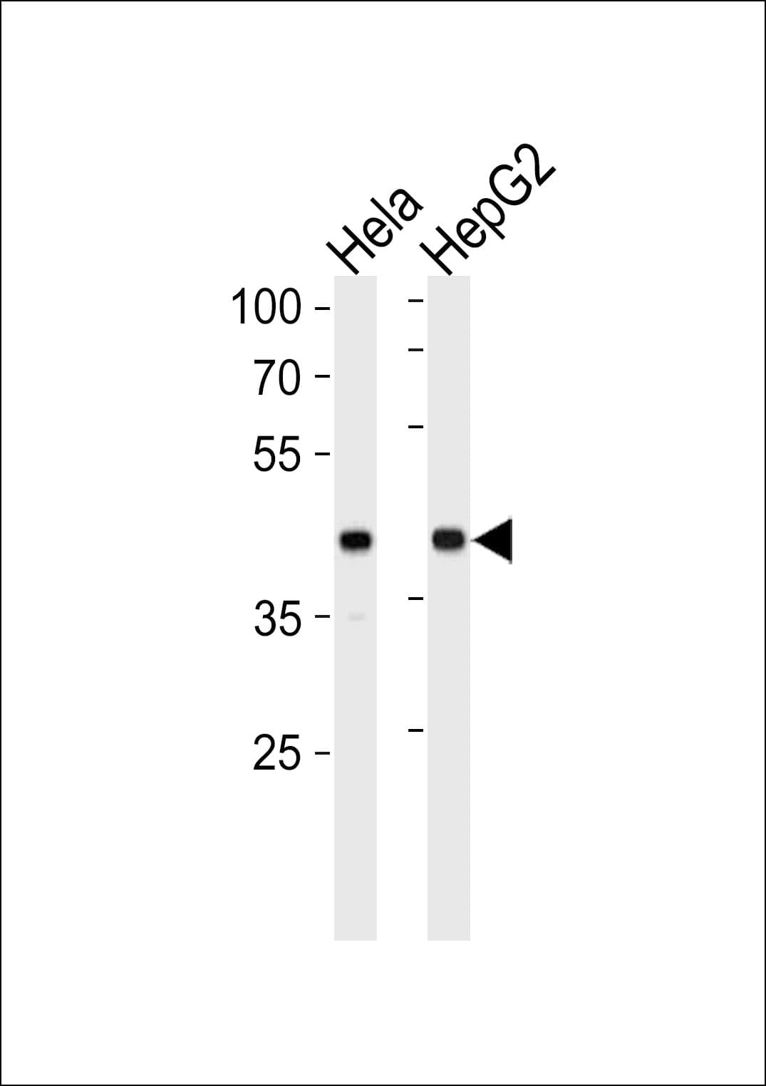 LRPAP1 Antibody (aa281-309)