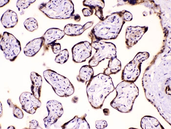CAST / Calpastatin Antibody