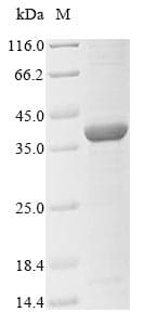 Neisseria meningitidis porB Protein (Recombinant 6His, N-terminus)
