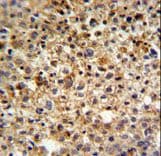Polyclonal Rabbit anti-Human CCDC180 / C9orf174 Antibody (aa1048-1077, IHC, WB)