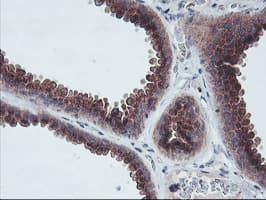 COPD / ARCN1 Antibody (clone OTI4H9)