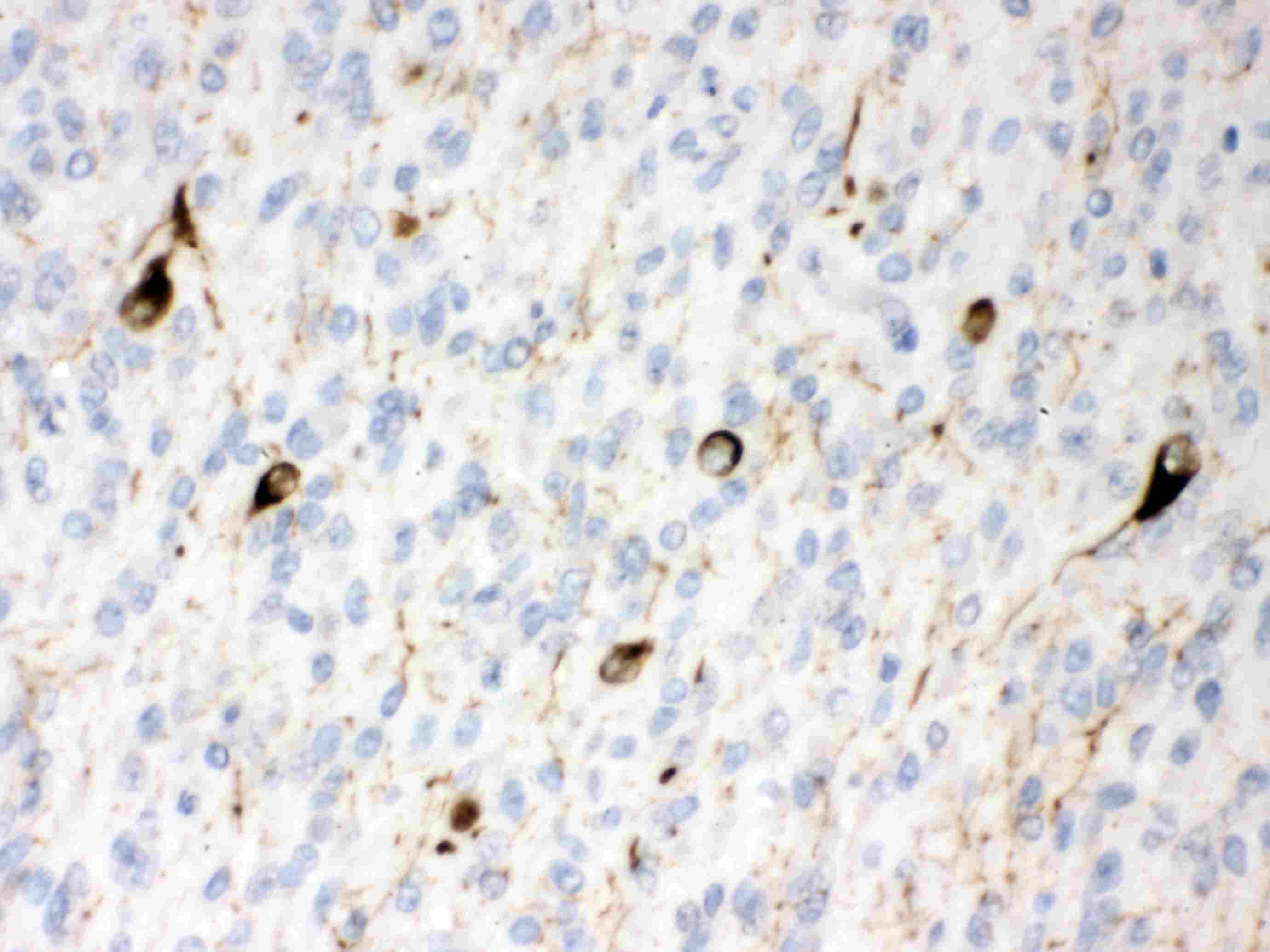 Polyclonal Rabbit anti-Human INA / Alpha Internexin Antibody (IHC, WB)