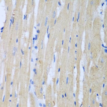 CSF3R / CD114 Antibody