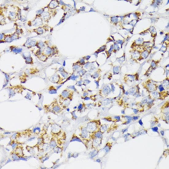Polyclonal Rabbit anti-Human USP33 / VDU1 Antibody (IHC, IF, WB)