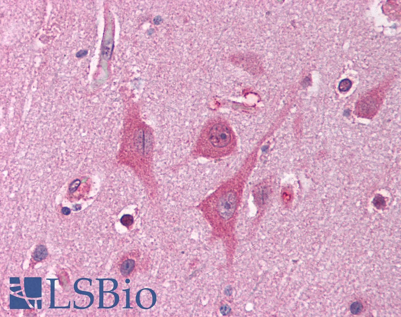 HNRNPUL1 Antibody (aa48-97)
