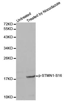 Polyclonal Rabbit anti-Human STMN1 / Stathmin / LAG Antibody (phospho-Ser16, IHC, WB)
