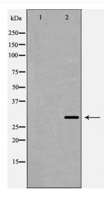 Polyclonal Rabbit anti-Human SIRT3 / Sirtuin 3 Antibody (IHC, WB)