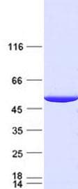 Human IDH1 / IDH Protein (Recombinant Myc-DDK (Flag), C-terminus)