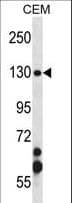 SMC3 / HCAP Antibody (aa402-430)