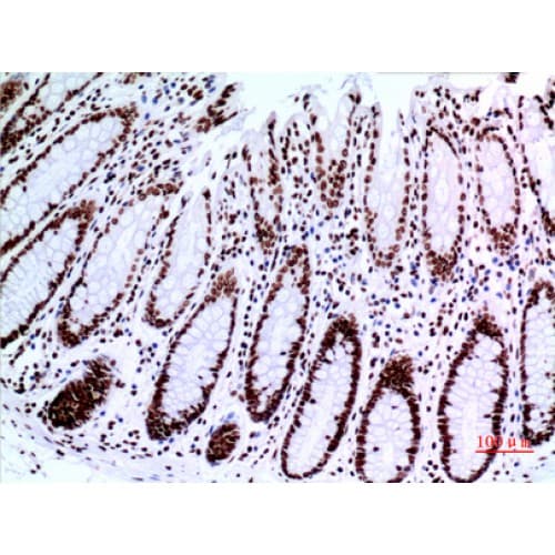 Polyclonal Rabbit anti-Human TP73 / p73 Antibody (IHC, WB)