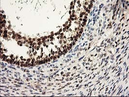 PRMT2 Antibody (clone OTI3A3)