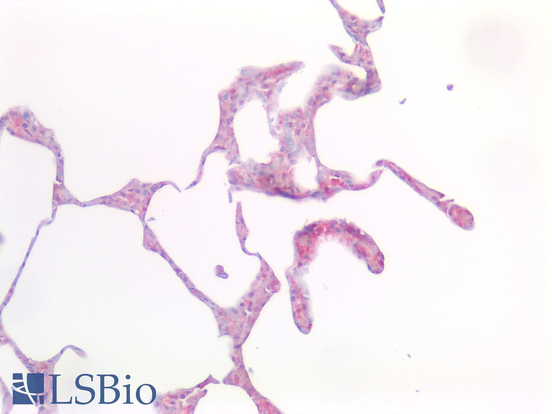 TREM2 / TREM-2 Antibody