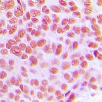 Polyclonal Rabbit anti-Human TFAP2C / AP2 Gamma Antibody (C-Terminus, IHC, WB)