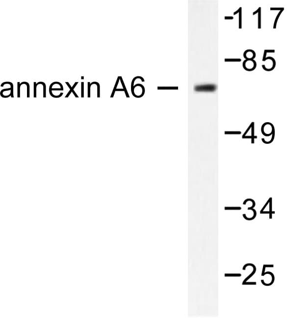 ANXA6/Annexin A6/Annexin VI Antibody (Ala5)