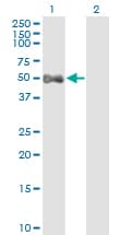 ALDH9A1 Antibody (clone 3C6)