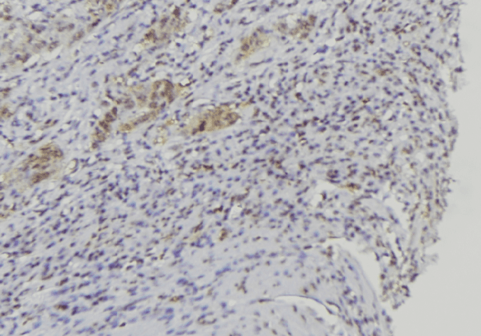 BPIFA1 / SPLUNC1 Antibody