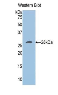 UCHL3 Antibody (aa2-230)