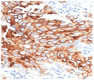 MSLN / Mesothelin Antibody (clone MKPF-1)