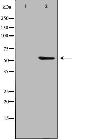PPP2R3C Antibody