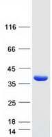 Human ADO Protein (Recombinant Myc-DDK (Flag))