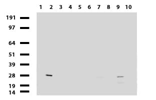 MMP7 / Matrilysin Antibody (aa95-267, clone UMAB168, Carrier-free)