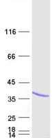 Human NAA10 / ARD1A Protein (Recombinant Myc-DDK (Flag))