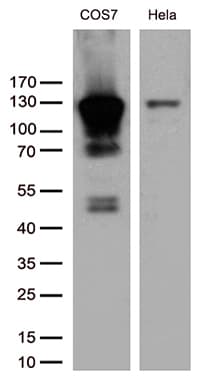Monoclonal Mouse anti-Human RB1 / Retinoblastoma / RB Antibody (clone OTI11C10, aa309-590, IHC, WB)