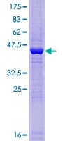 Human RNASEH2C / AGS3 Protein (Recombinant GST)