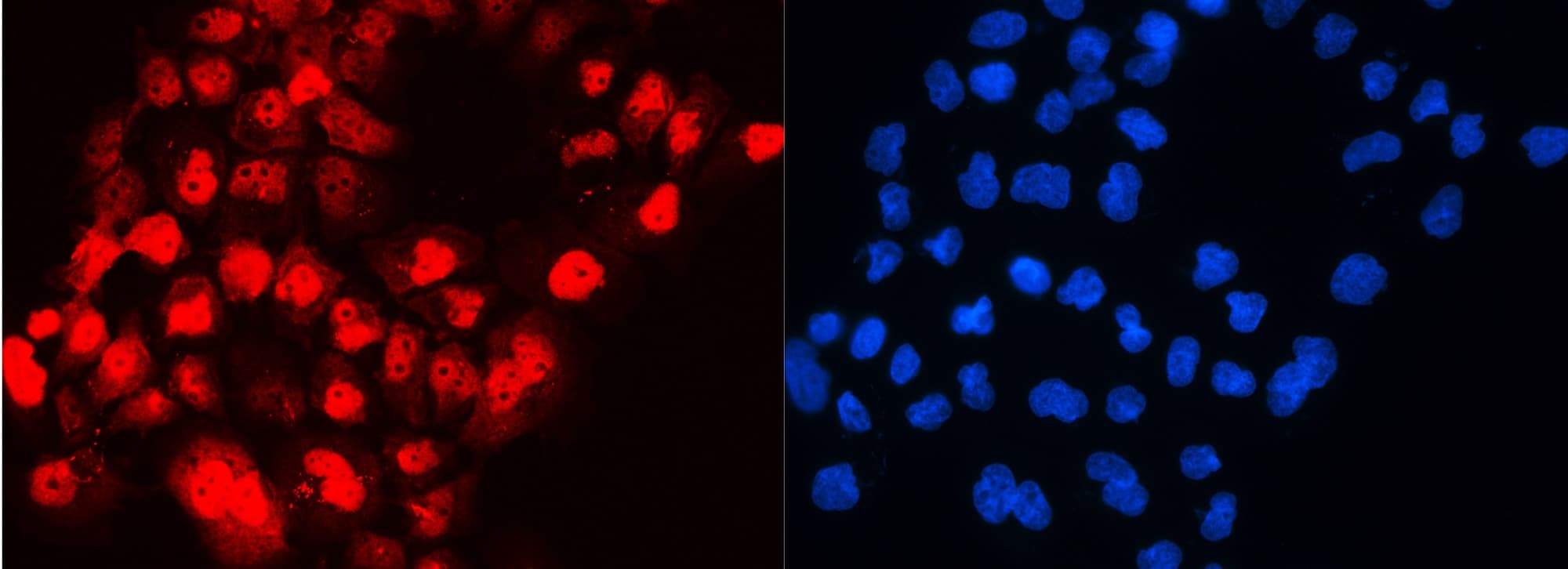 ACLY / ATP Citrate Lyase Antibody