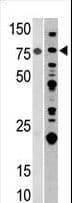 IHC-plus™ ACO2 / Aconitase 2 Antibody (aa438-467)
