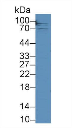 CD71 / Transferrin Receptor Antibody (aa578-765)