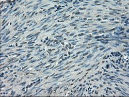 SLC2A5 / GLUT5 Antibody (clone OTI2C4)