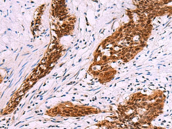 FKBP4 / FKBP52 Antibody