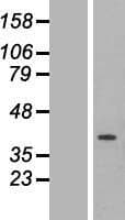 Human ETFA Protein (Over-Expression Lysate Myc-DDK (Flag))