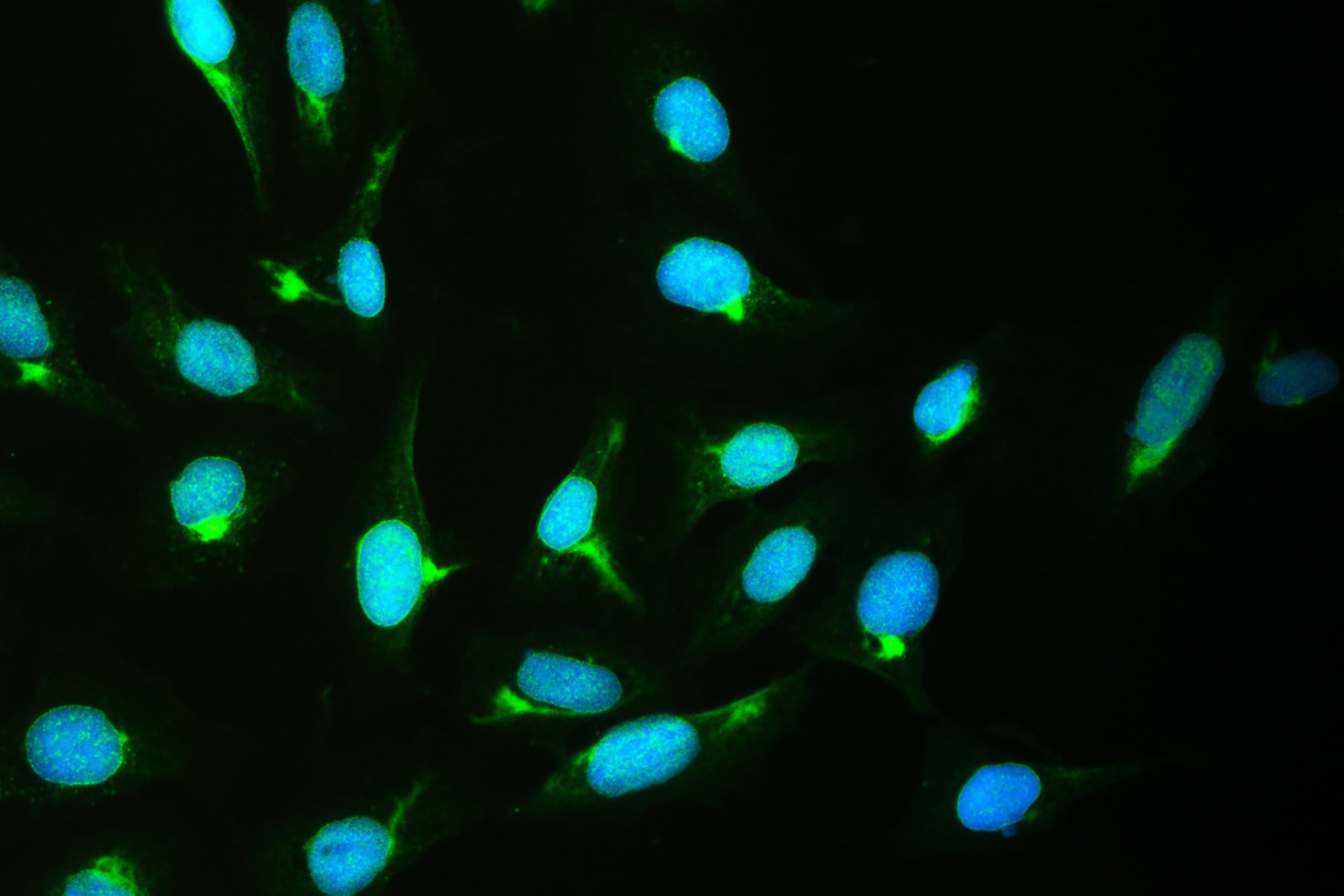 XPO1 / CRM1 Antibody