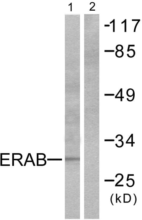 HSD17B10 / HADH2 Antibody