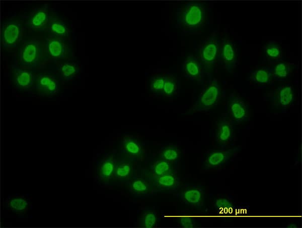 IHC-plus™ HDAC1 Antibody (clone 5A11)