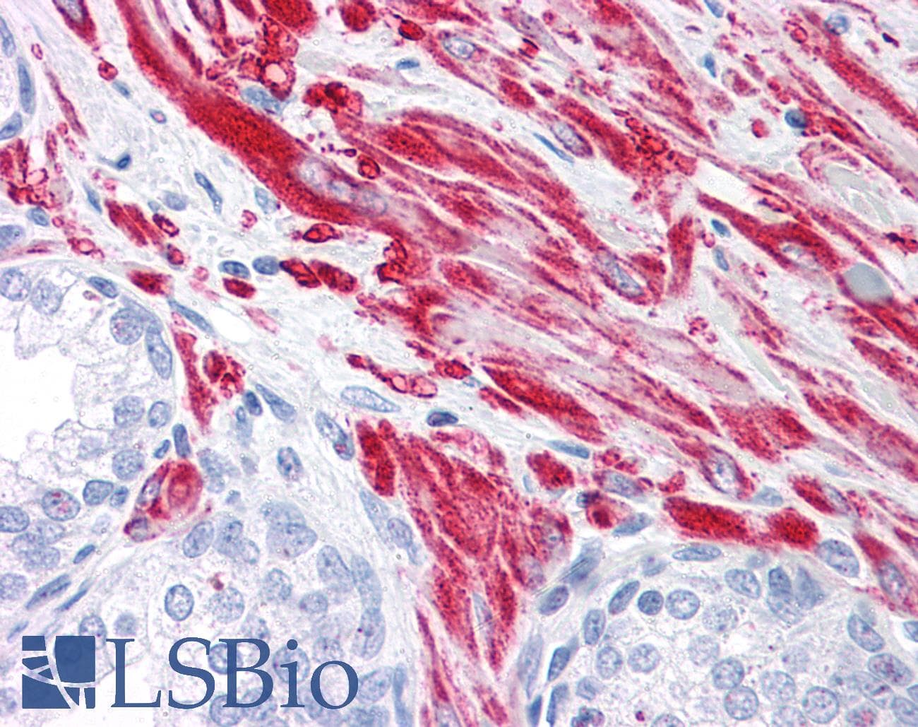 IHC-plus™ TBC1D4 / AS160 Antibody