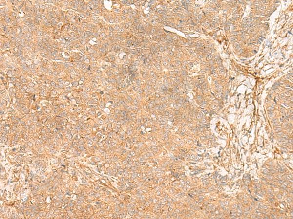 Polyclonal Rabbit anti-Human ABP-280 / FLNC Antibody (IHC, WB)
